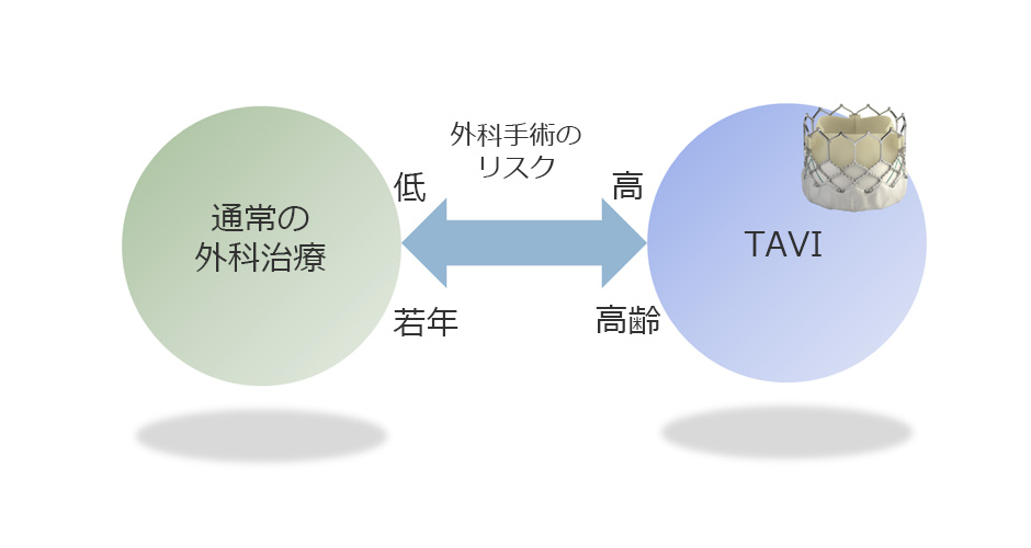 治療法の選択