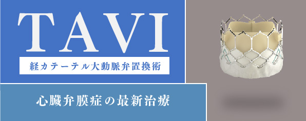 TAVI 経カテーテル大動脈弁置換術